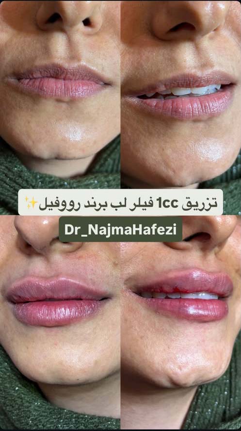 نمونه-11