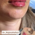تست استوری 5
