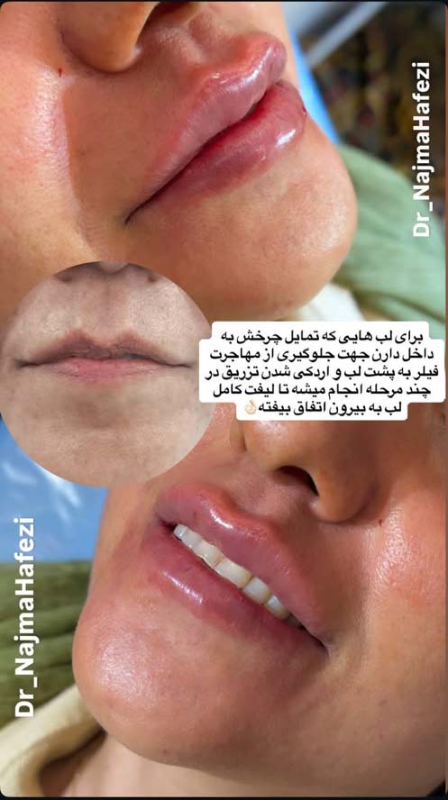 نمونه-13
