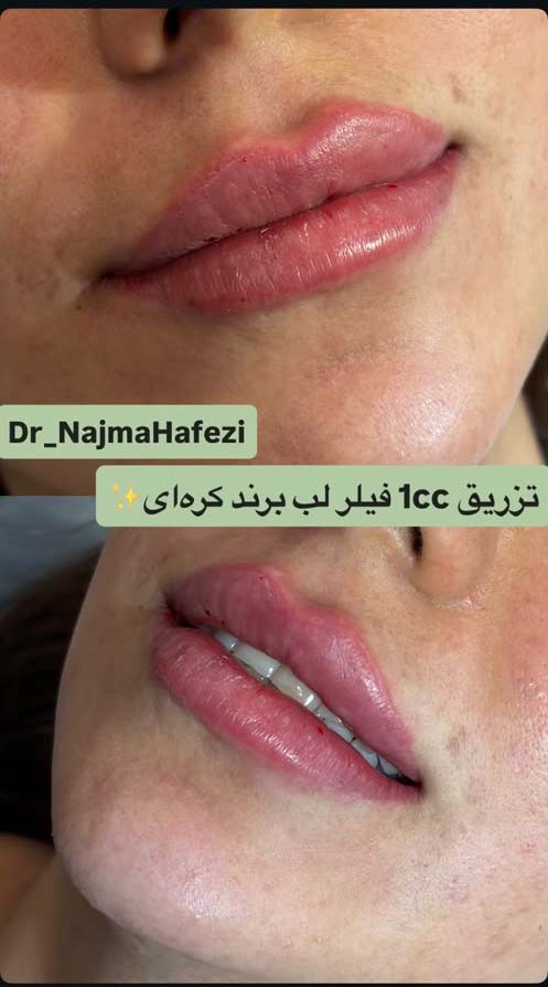 نمونه-14